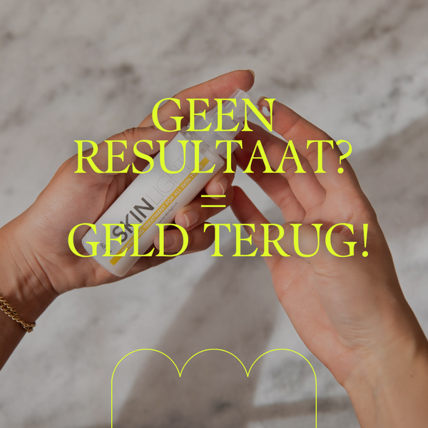 Skinlight Pigmentvlekken creme 60ML